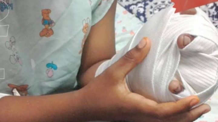 Cinco quemados con pólvora dejó Noche de Velitas en Norte de Santander