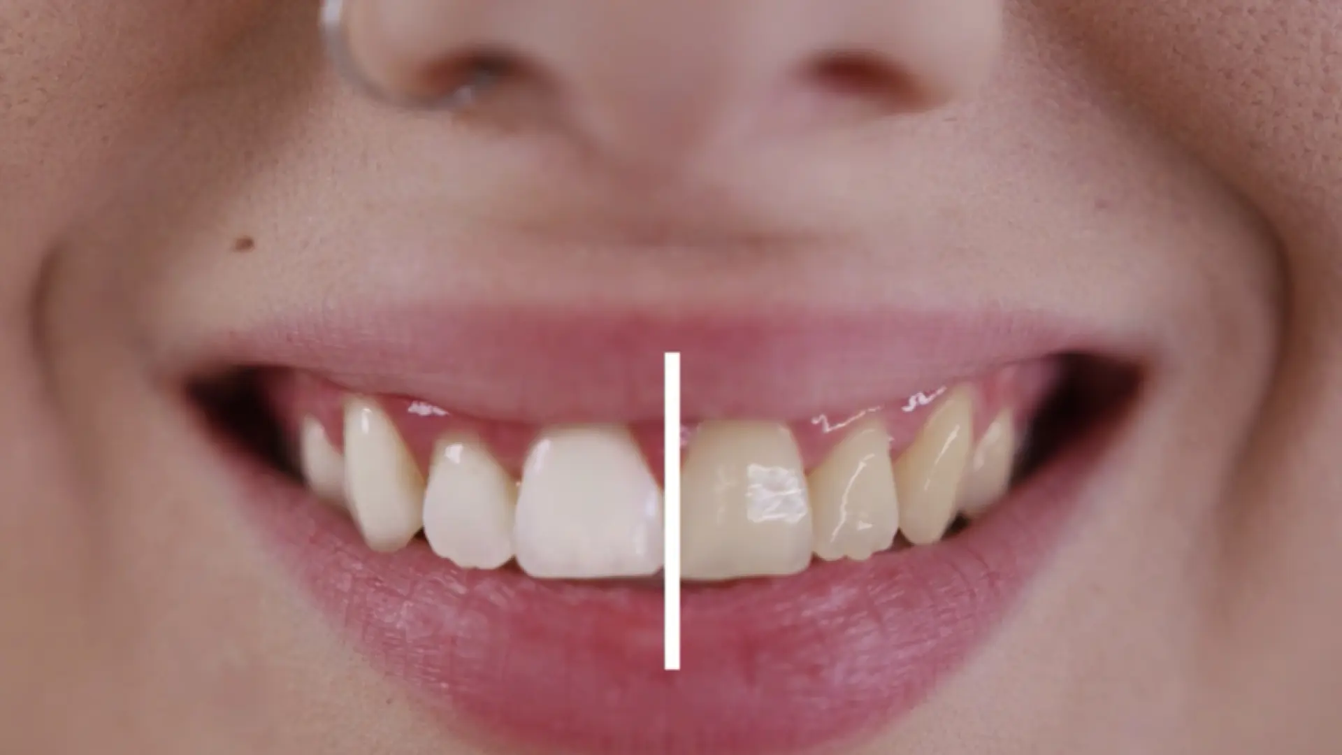 El error poco conocido al cepillarse los dientes que podría volverlos amarillos