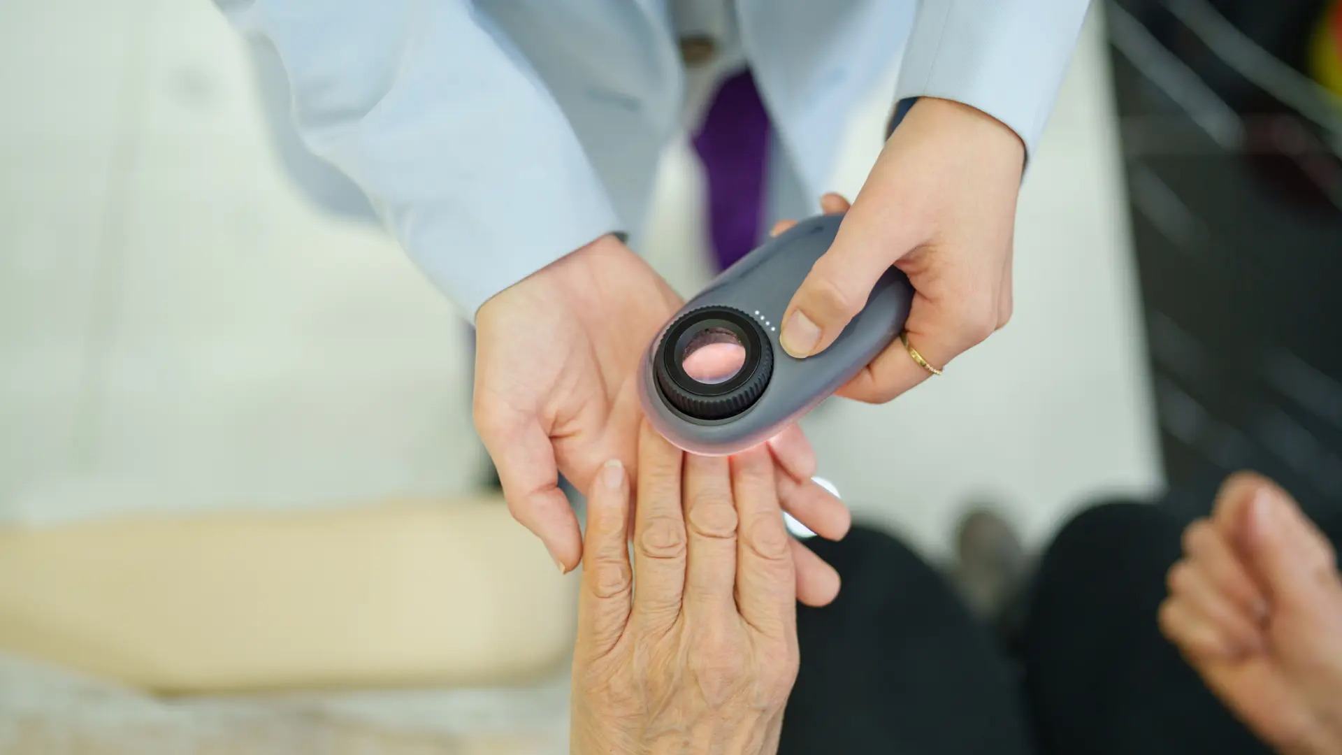causas, primeros síntomas y prevención