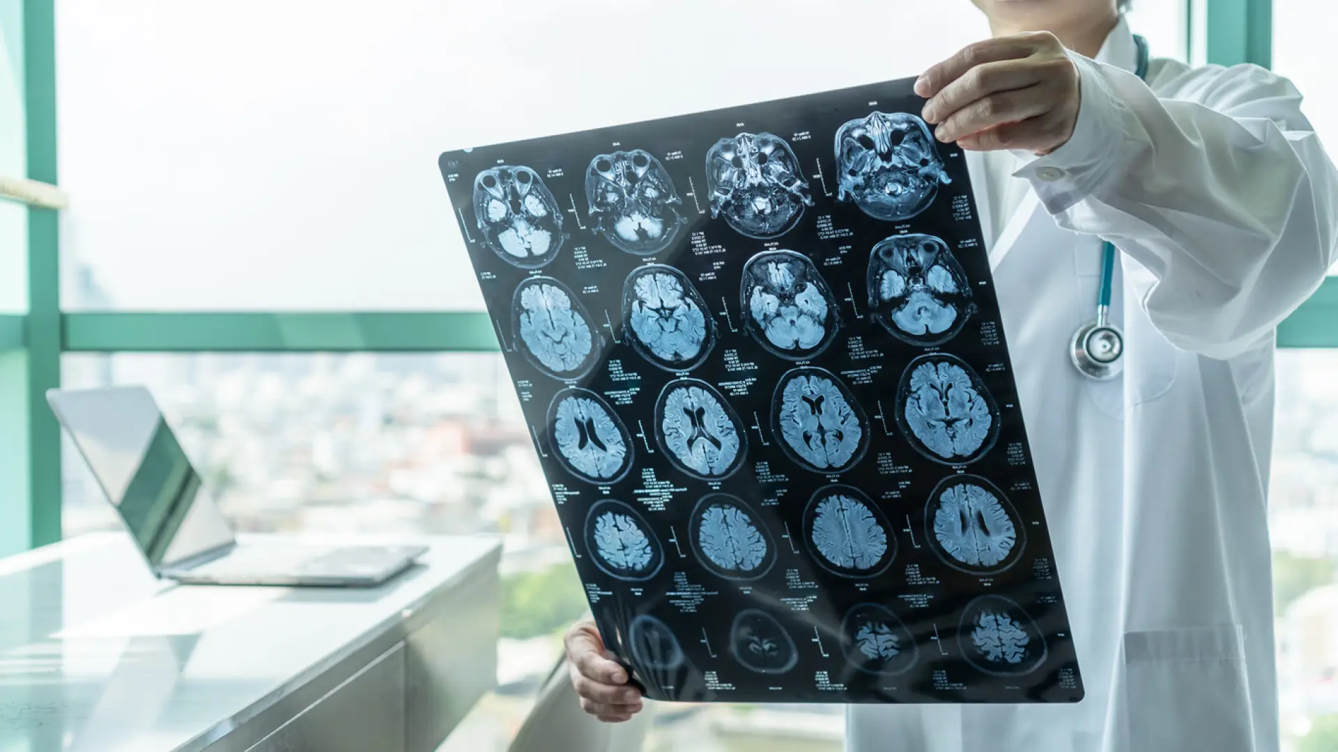 Algunas personas con alzhéimer no muestran síntomas: ¿cuál es el motivo?