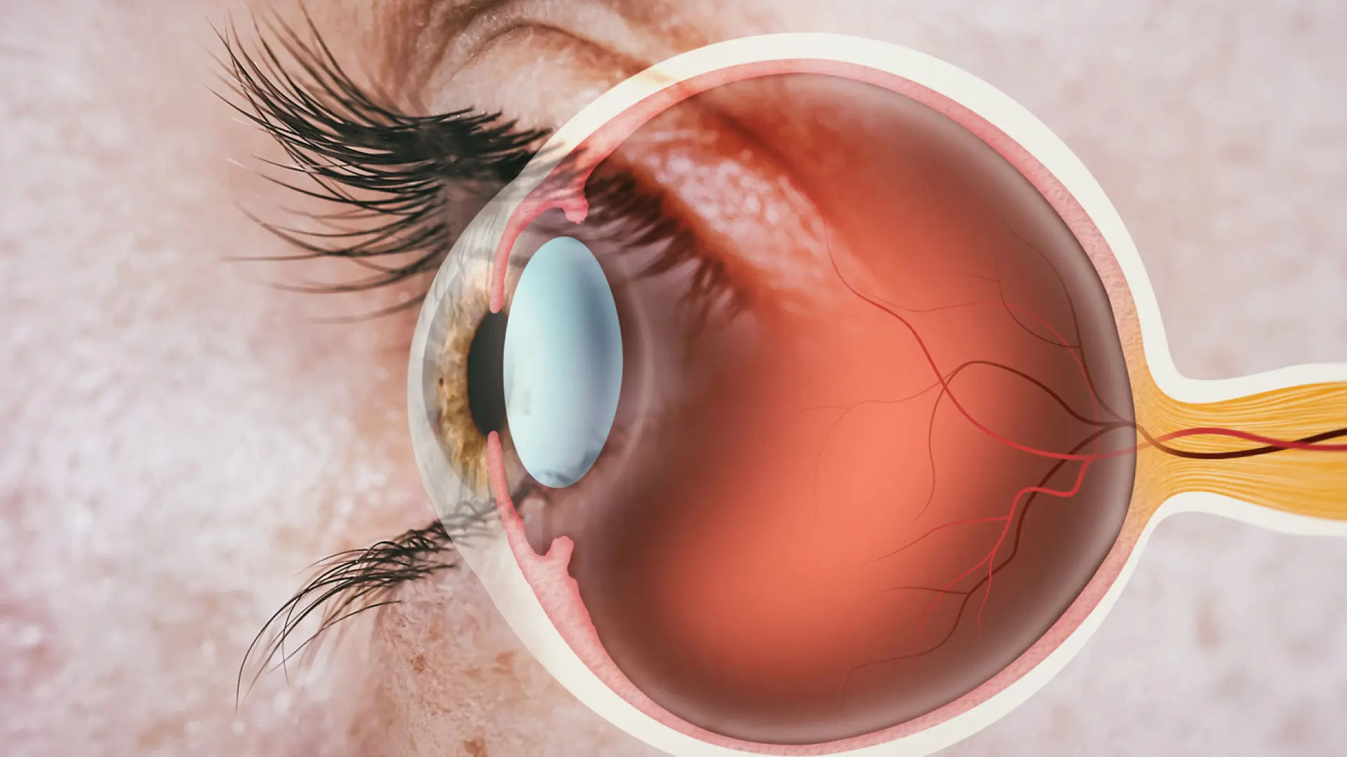 Las enfermedades de la retina se disparan en los últimos años en España