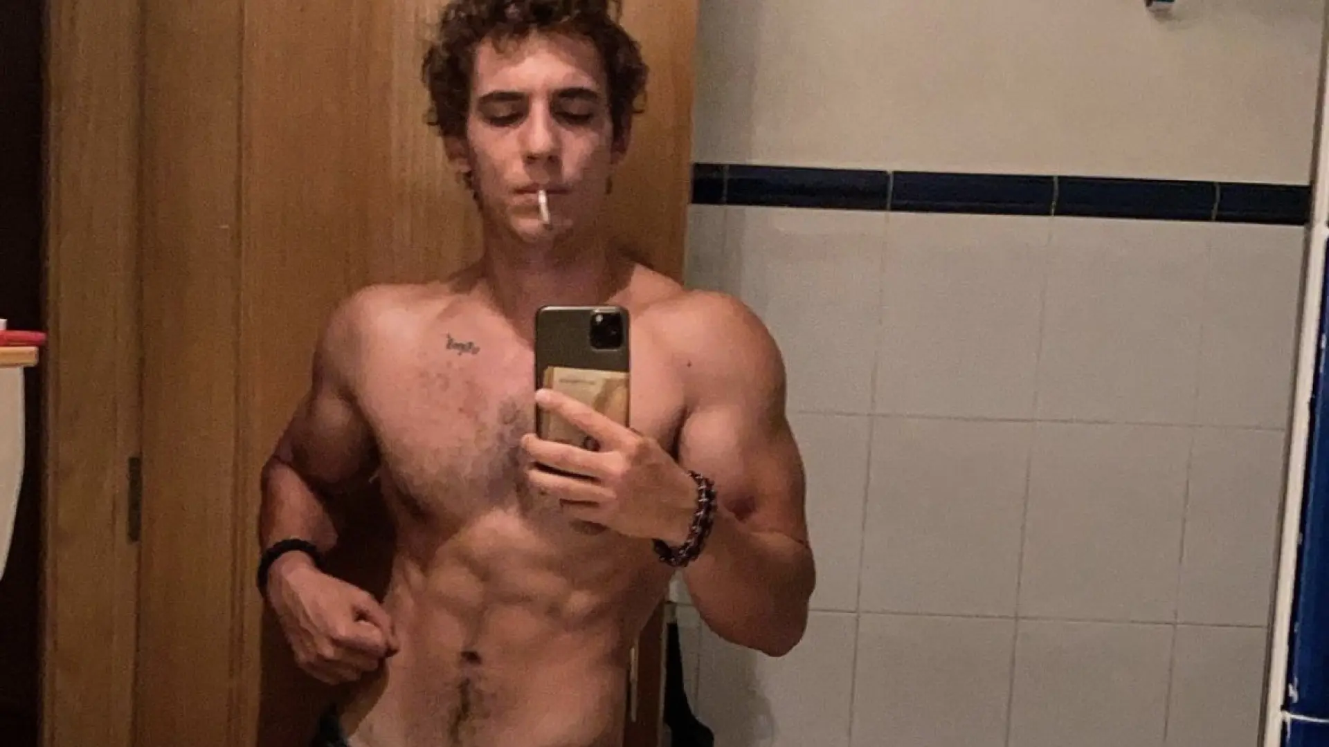 el problema de salud relacionado con los músculos que ha padecido Miguel Herrán