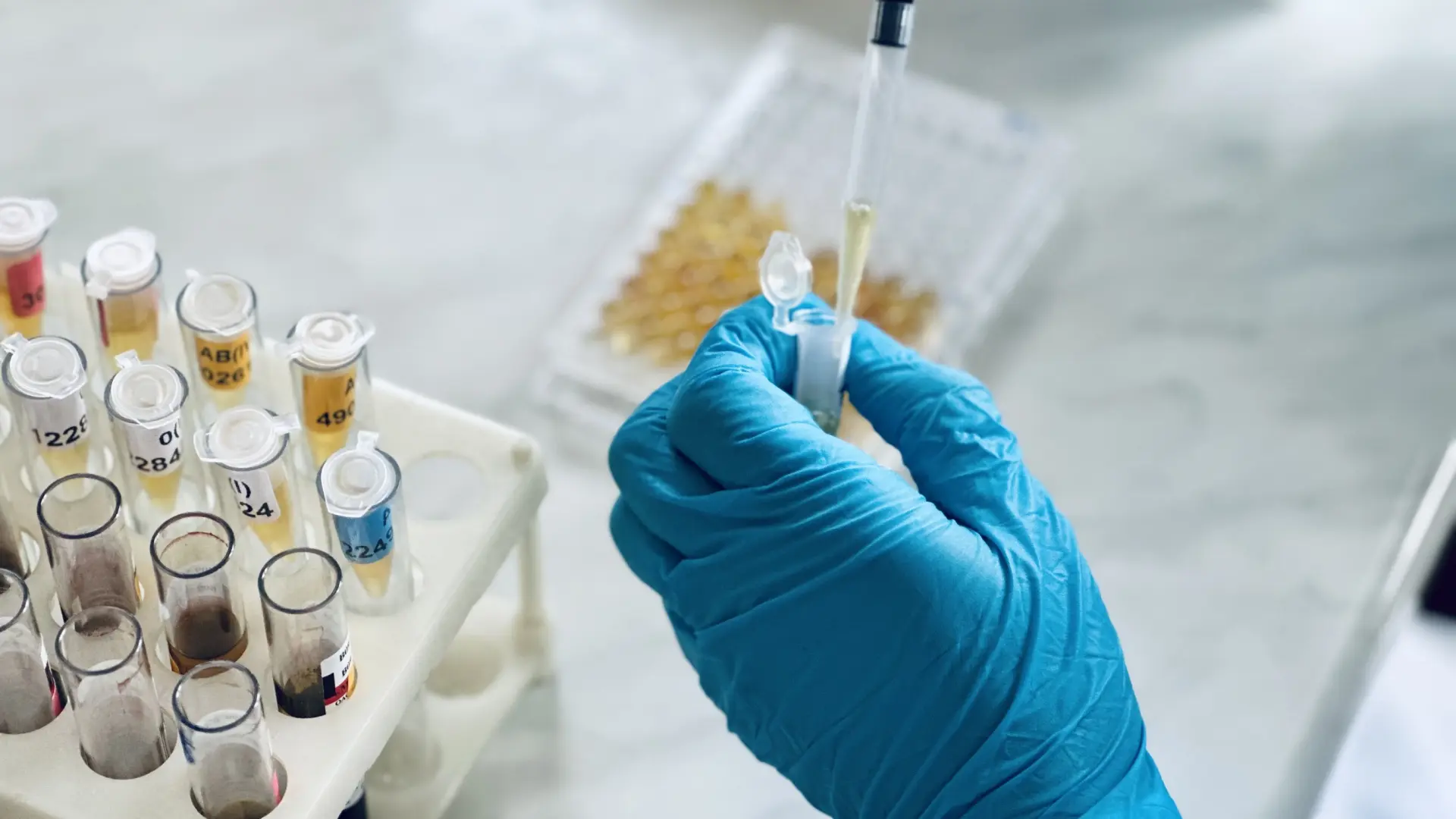 Un nuevo test de sangre para detectar el alzhéimer muestra resultados prometedores en un ensayo clínico