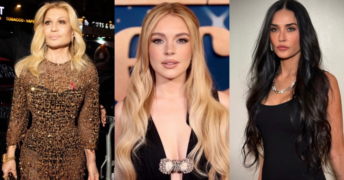 Lindsay Lohan, Donatella Versace: ¿Qué cirugía se hicieron?