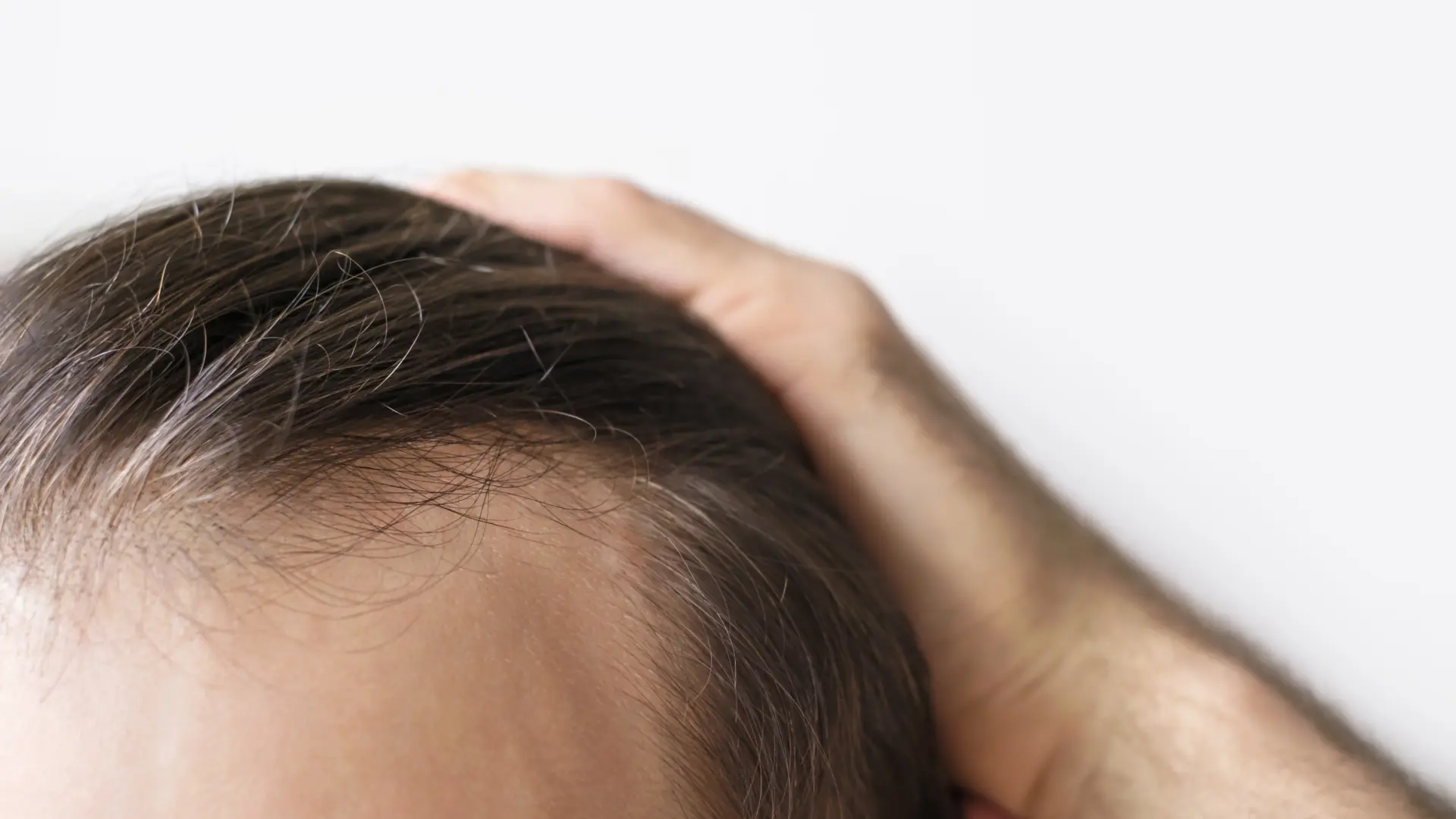 puede provocar pérdida de pelo