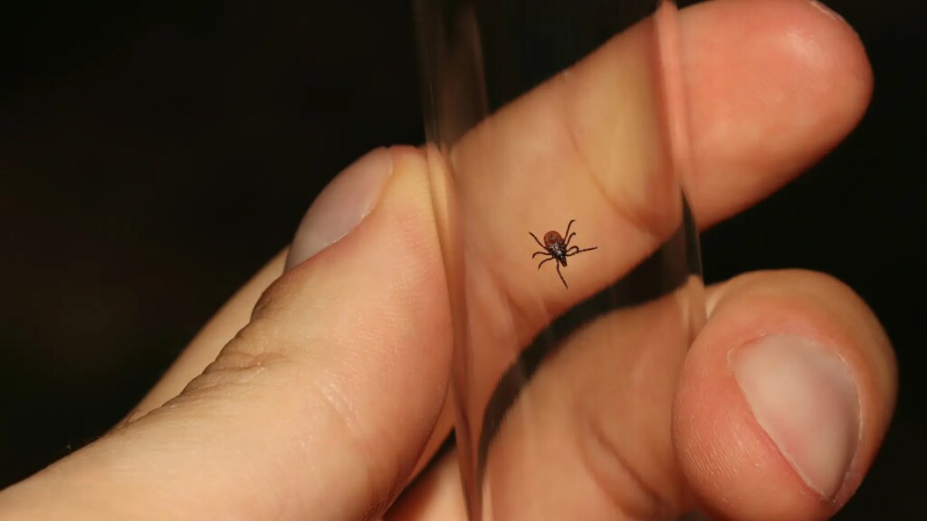 Entre el 5% y el 20% de las personas con encefalitis fallecen, es clave la vacunación y evitar picaduras de mosquitos y garrapatas