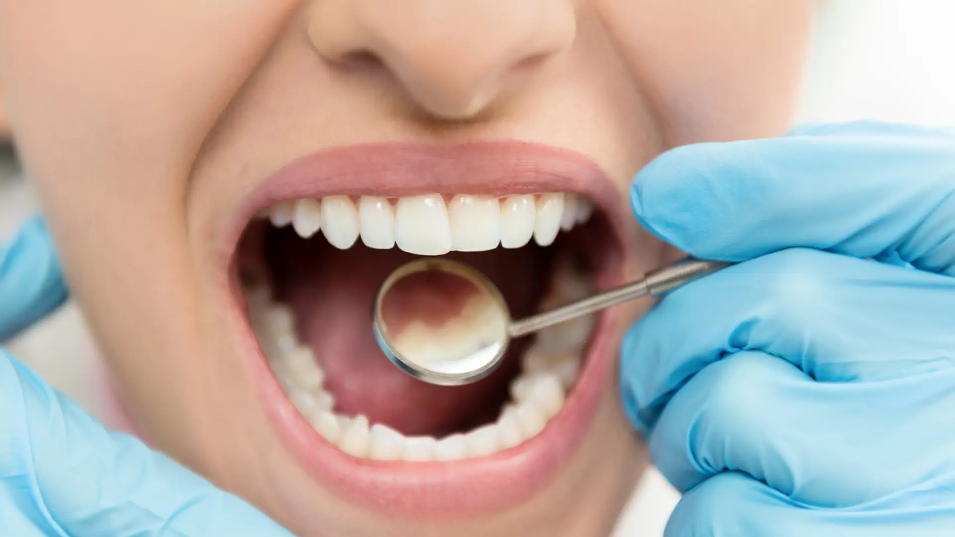 Lo que provoca más caries a principios de año según los dentistas